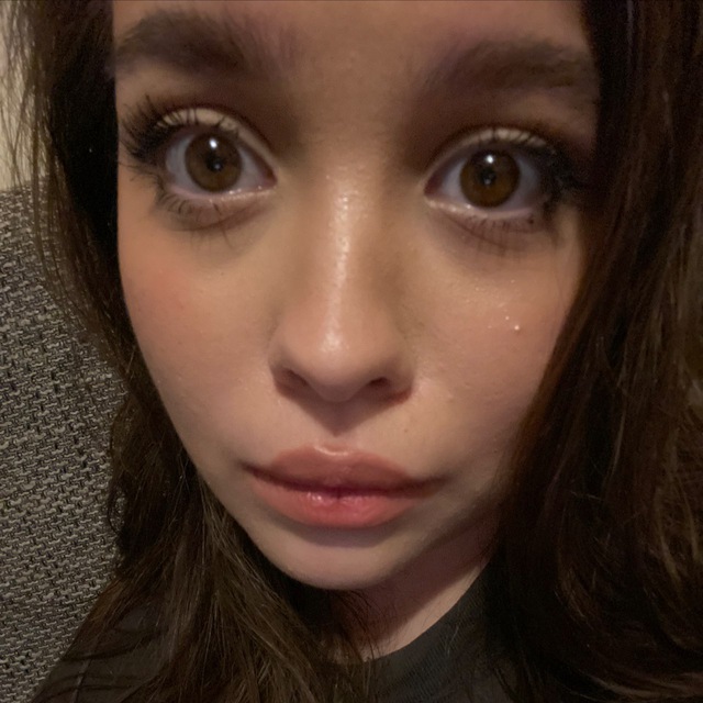 прострация